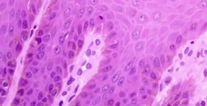 Sezione istologica osservata al microscopio, evidenziata in rosa e viola, con strutture cellulari visibili.