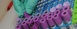 Vassoio blu con diverse provette con coperchi viola, una mano con guanto verde tocca una provetta, utilizzate per raccolta campioni di sangue.