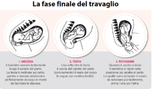  Illustrazione delle tre fasi finali del travaglio: Discesa, Testa e Rotazione del bambino durante il parto.
