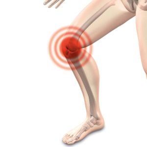 Ginocchio: Anatomia, Trattamenti e Prevenzione