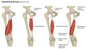 Diagramma anatomico dei muscoli ischiocrurali con origine e inserzione di semitendinoso, semimembranoso e bicipite femorale