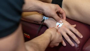 Applicazione di elettrodi per un test di bioimpedenziometria BIA sull’avambraccio, usato per misurare massa grassa, massa magra e acqua corporea.