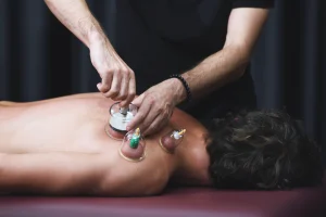 Terapista maschile applica coppette trasparenti sul dorso di un paziente sdraiato, evidenziando la tecnica della coppettazione terapeutica.