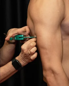 Operatore misura la plica cutanea del tricipite con un plicometro verde per la valutazione antropometrica e la stima della massa grassa.